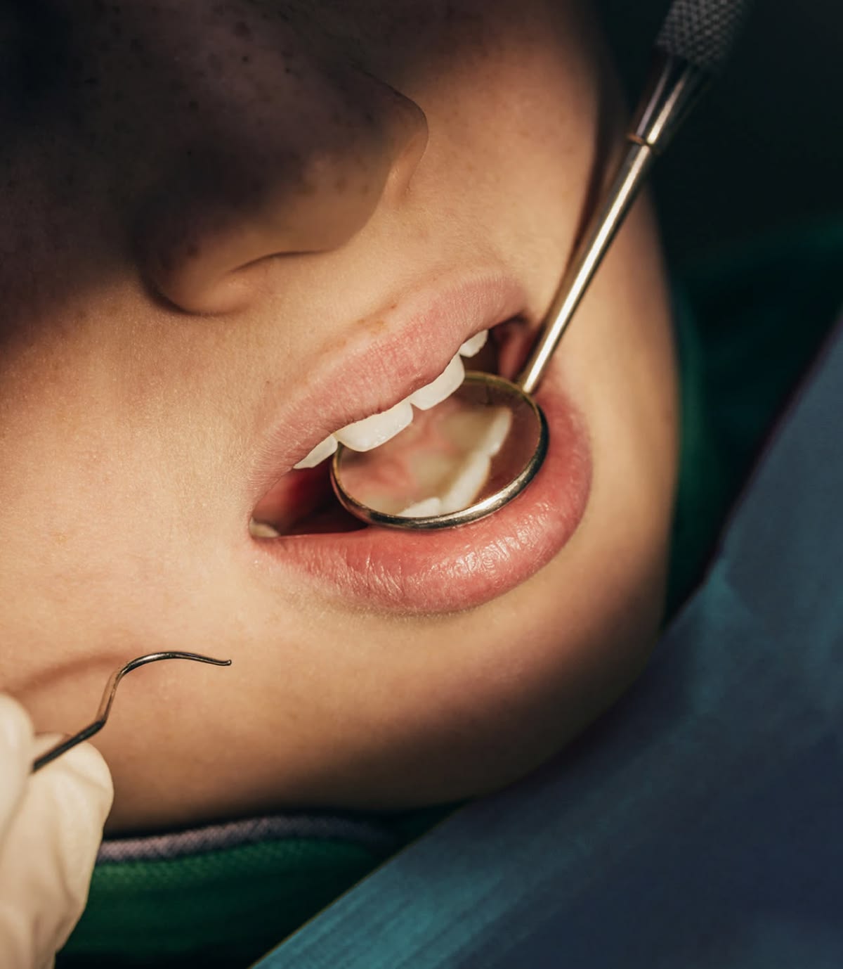 Young patient receiving a dental examination